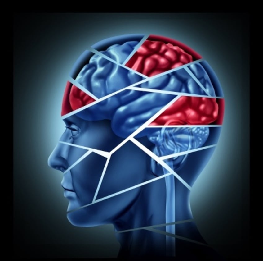 Acupuncture for PostConcussion Syndrome The Acupuncture Clinic