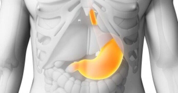 Visceral Hypersensitivity