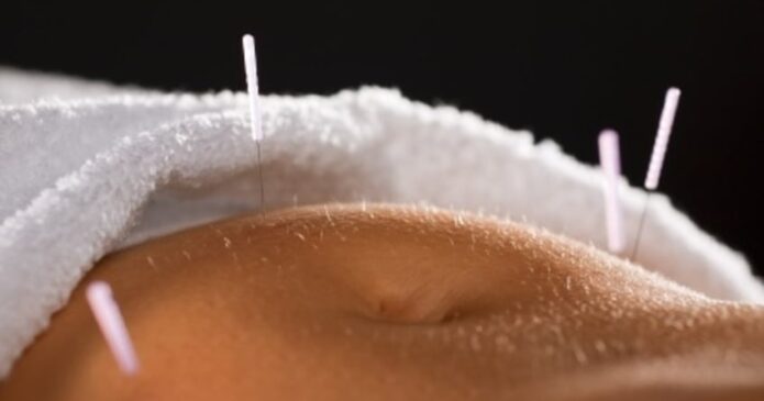 Acupuncture for uterine prolapse