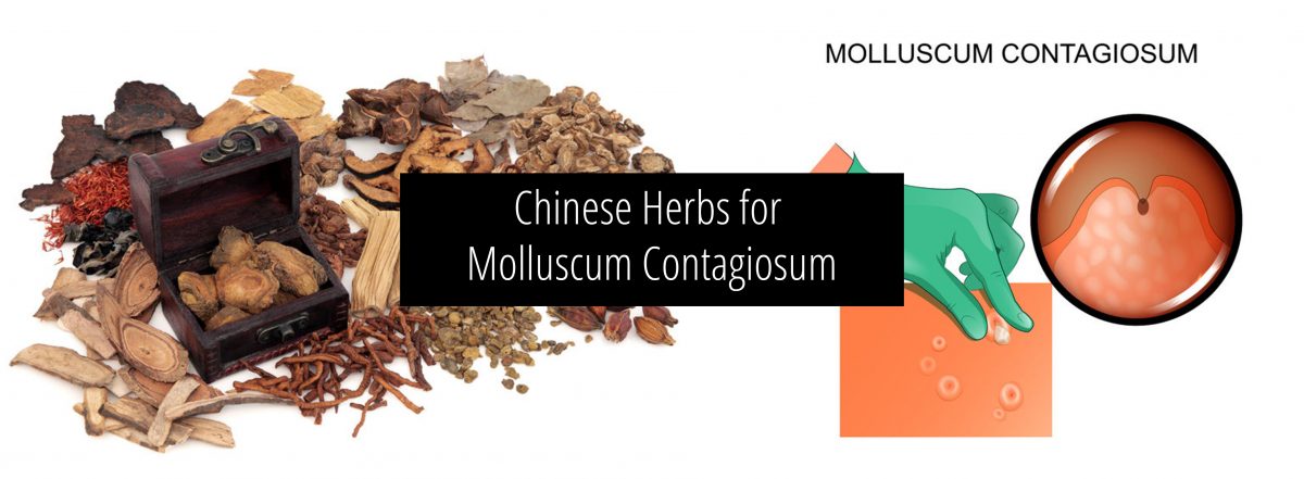 Chinese herbs for Molluscum Contagiosum