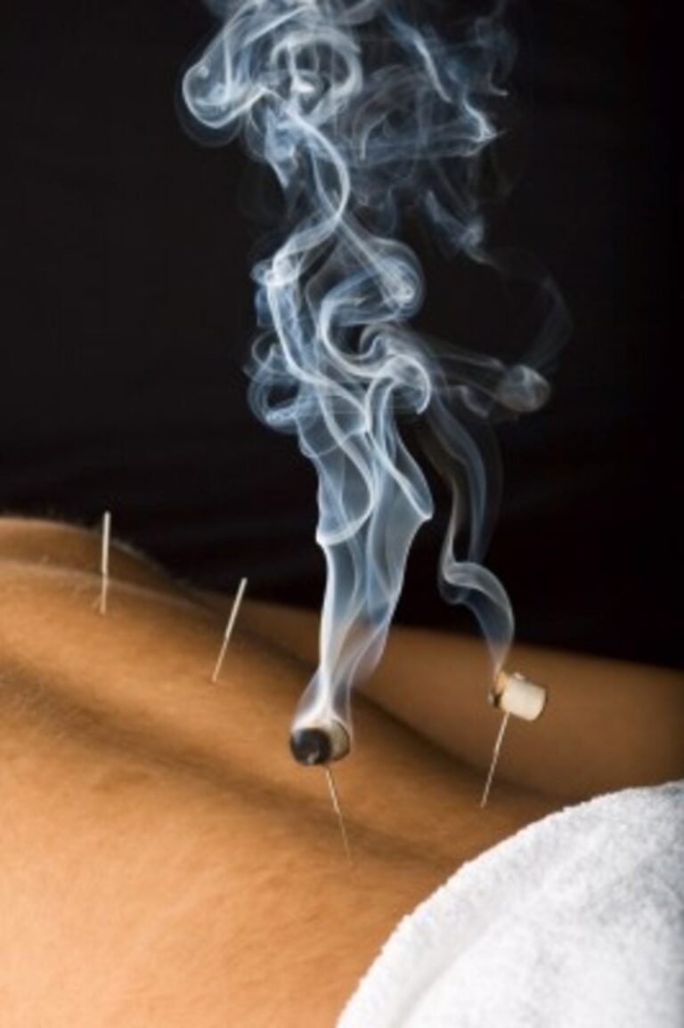 What is Moxibustion? The Acupuncture Clinic