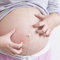 pregnant-itchy