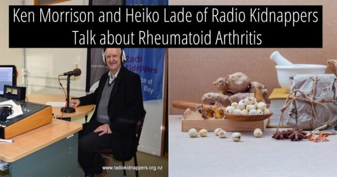 Rheumatoid Arthritis