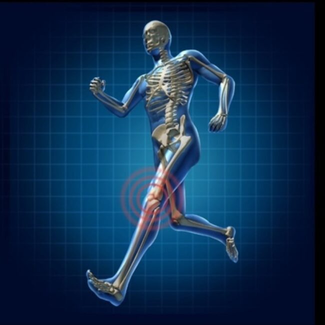 Acupuncture For Piriformis Syndrome