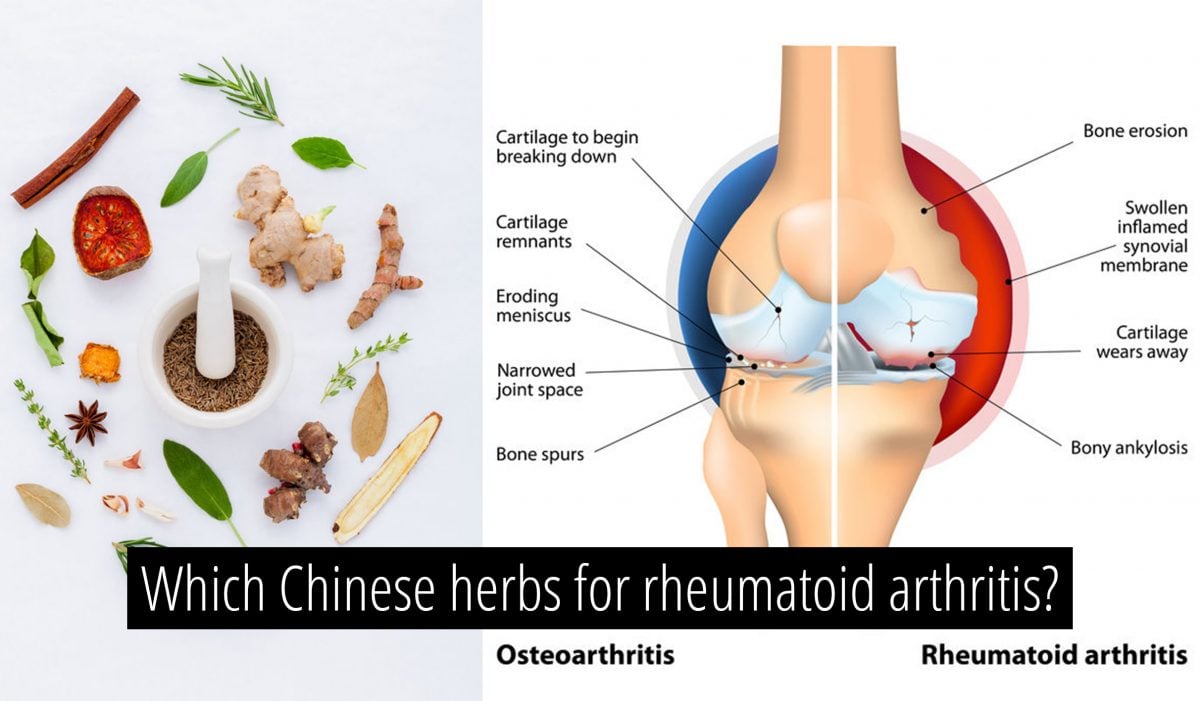 Which Chinese herbs for Rheumatoid Arthritis The Acupuncture Clinic