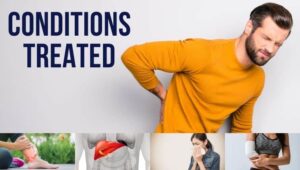 Acupuncture Treatment for Other Conditions | The Acupuncture Clinic