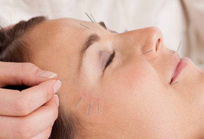Acupuncture for Sinus The Acupuncture Clinic